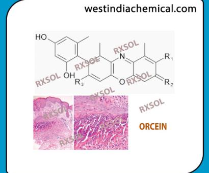 ORCEIN